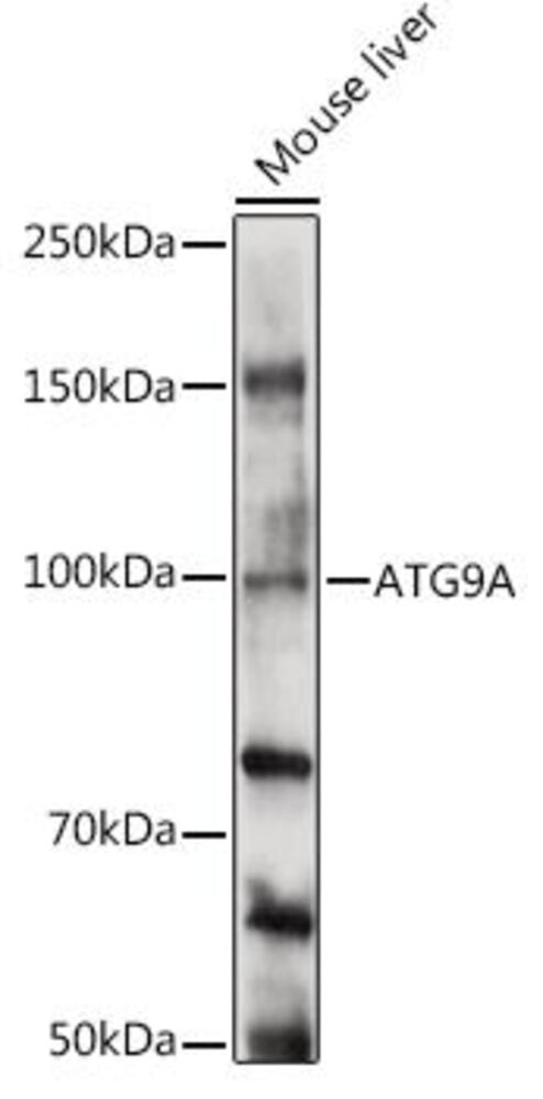 Anti-ATG9A Antibody, 100 µl - Luminix Health