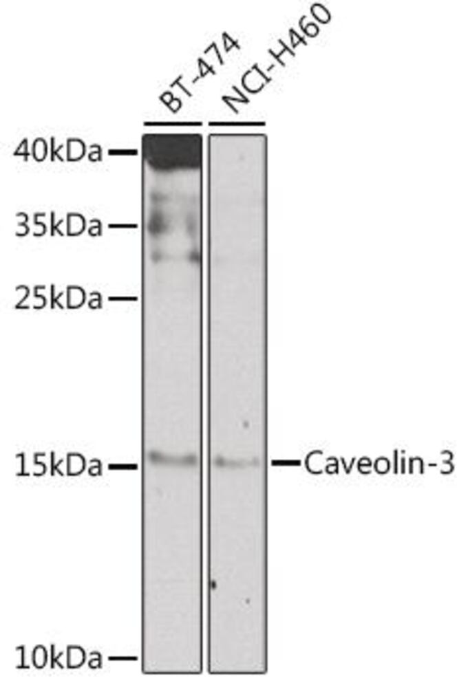 Anti-Caveolin-3 Antibody, 100 µl - Luminix Health