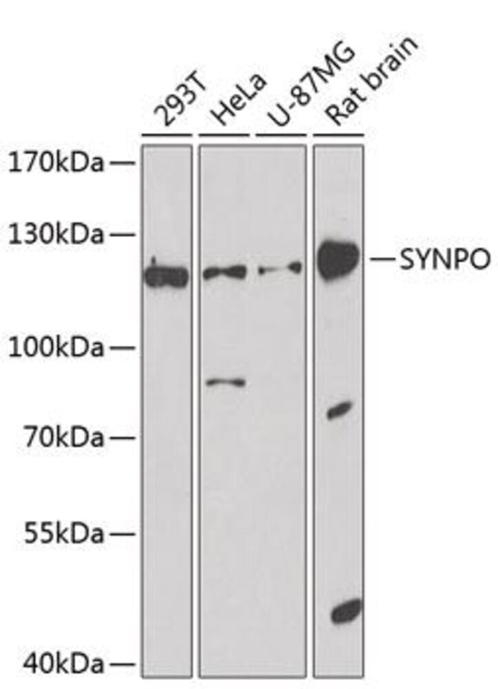 Anti-Synaptopodin Antibody, 100 µl - Luminix Health