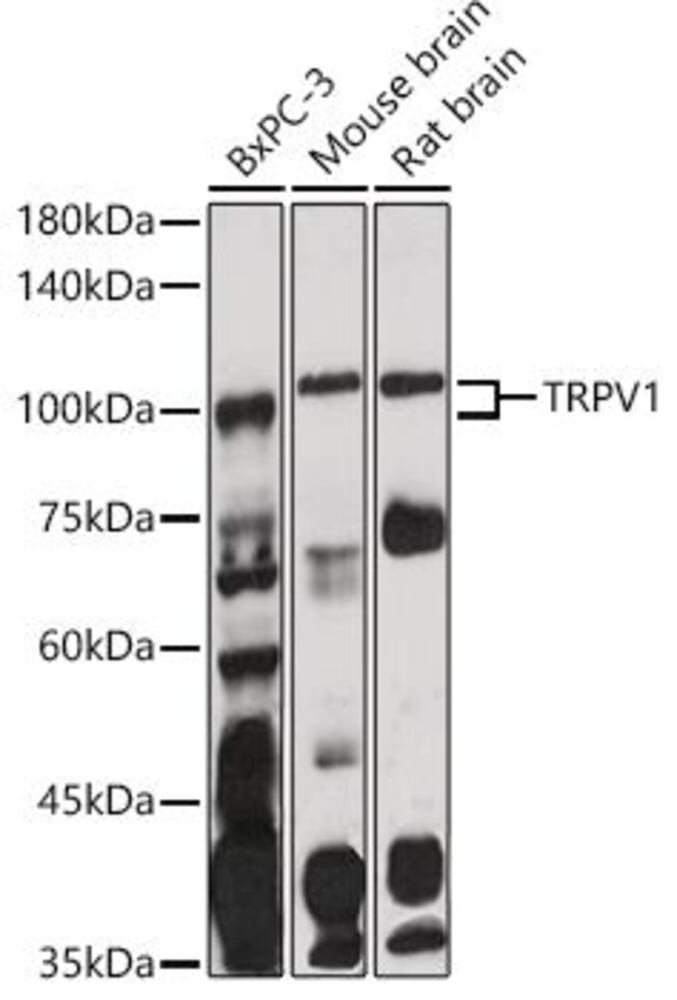 Anti-TRPV1 Antibody, 100 µl - Luminix Health