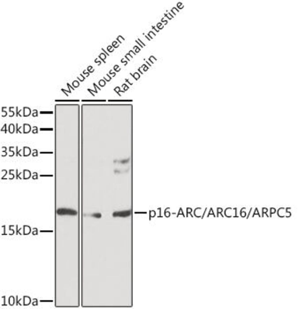 Anti-ARPC5 / p16 ARC Antibody, 100 µl - Luminix Health