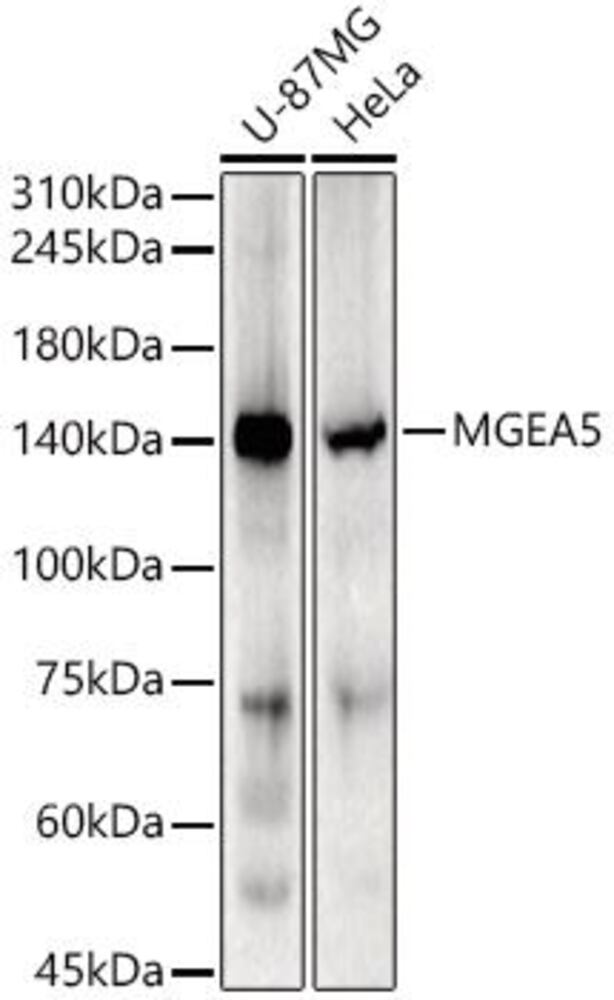 Anti-MGEA5 / OGA Antibody, 100 µl - Luminix Health