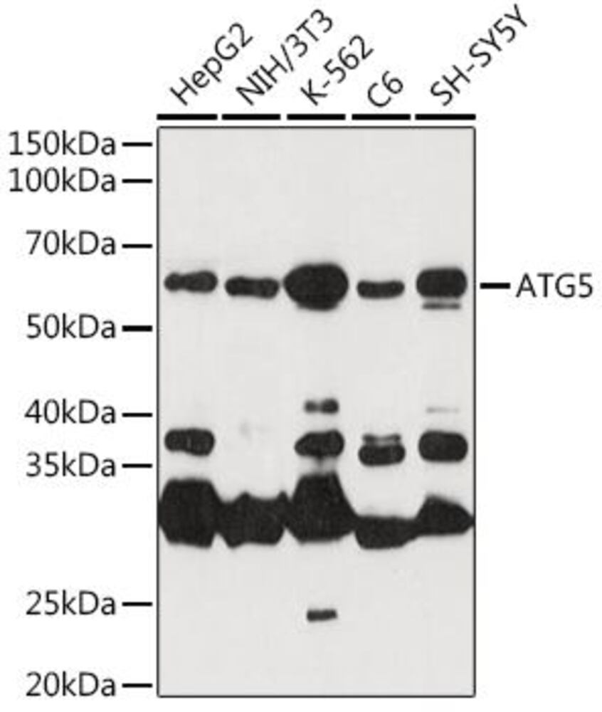 Anti-APG5L / ATG5 Antibody, 100 µl - Luminix Health