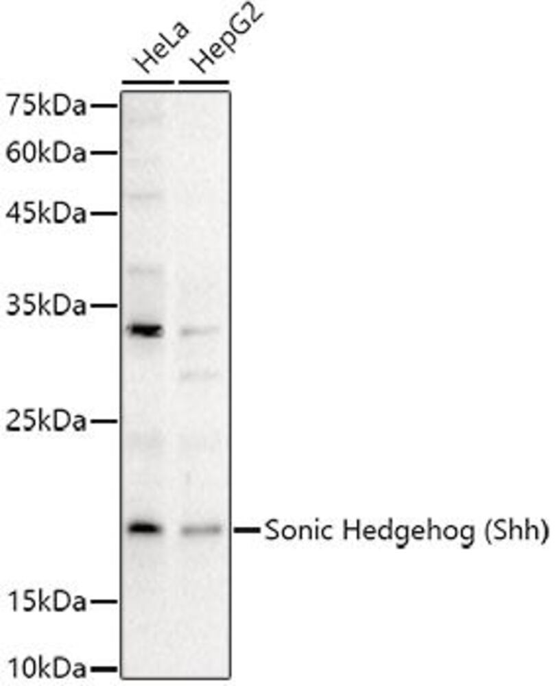 Anti-Sonic Hedgehog Antibody, 100 µl - Luminix Health