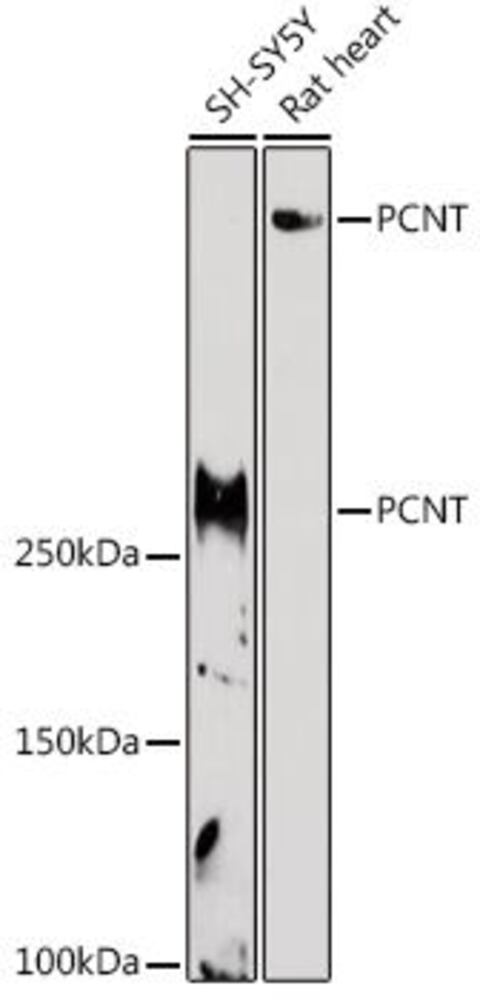 Anti-Pericentrin Antibody, 100 µl - Luminix Health