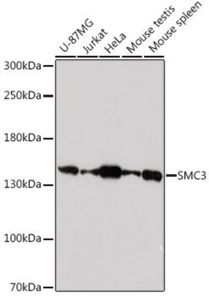Anti-SMC3 Antibody, 100 µl - Luminix Health