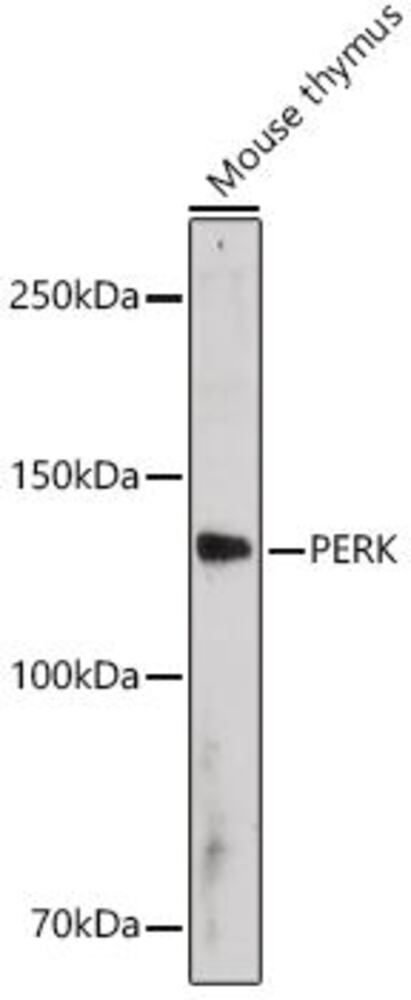Anti-PERK Antibody, 100 µl - Luminix Health