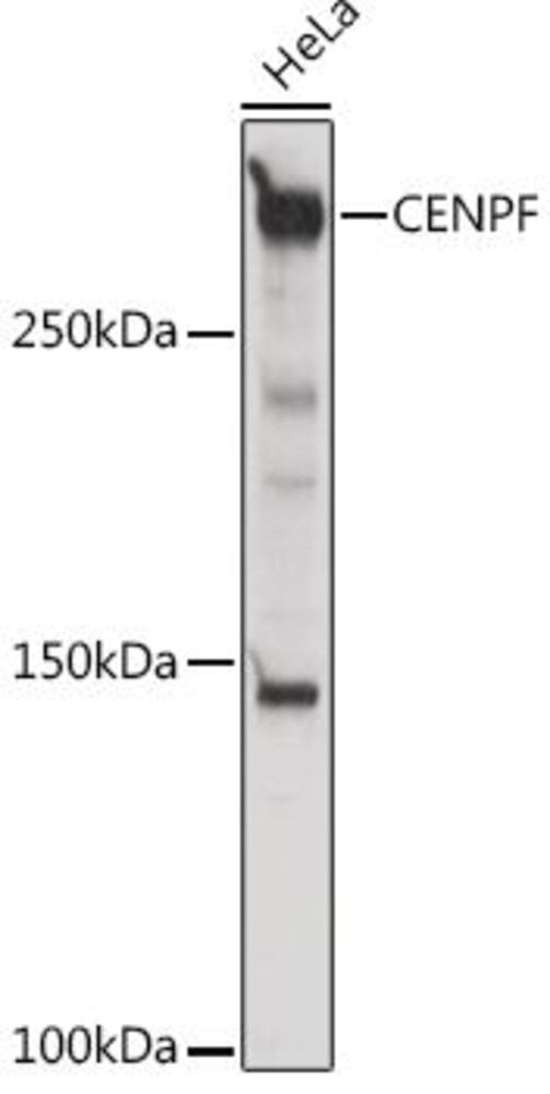 Anti-CENPF Antibody, 100 µl - Luminix Health
