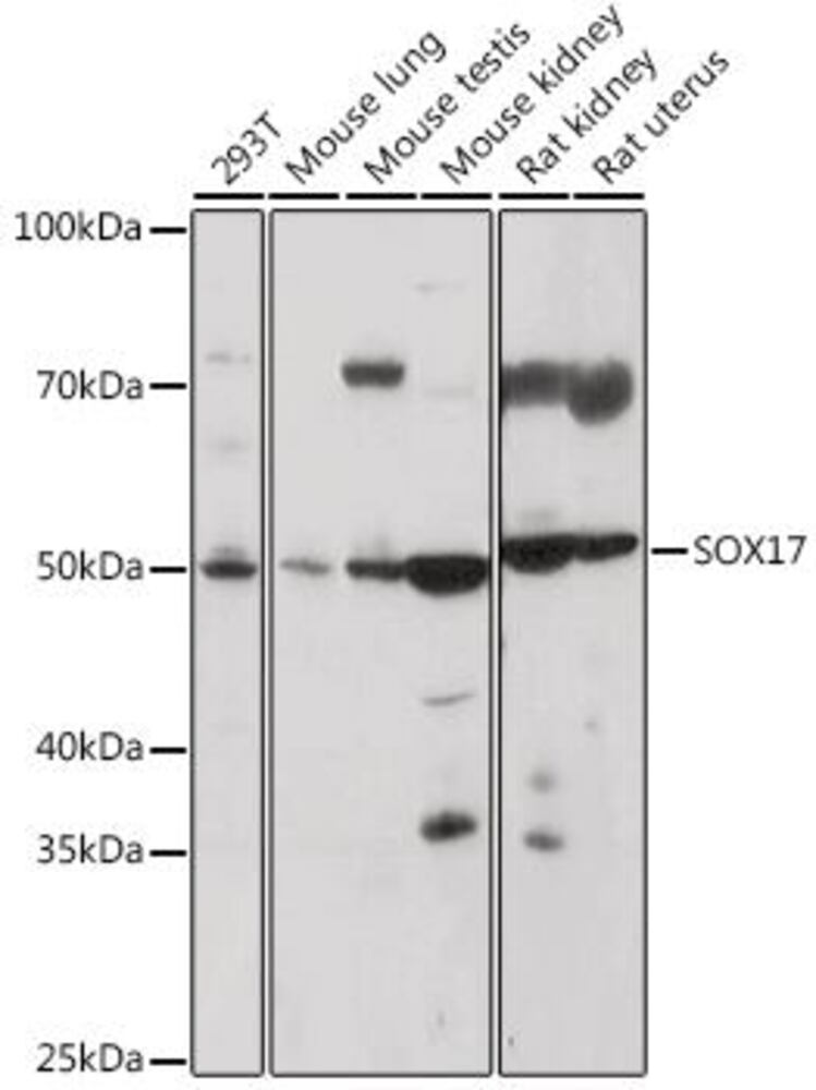 Anti-SOX17 Antibody, 100 µl - Luminix Health