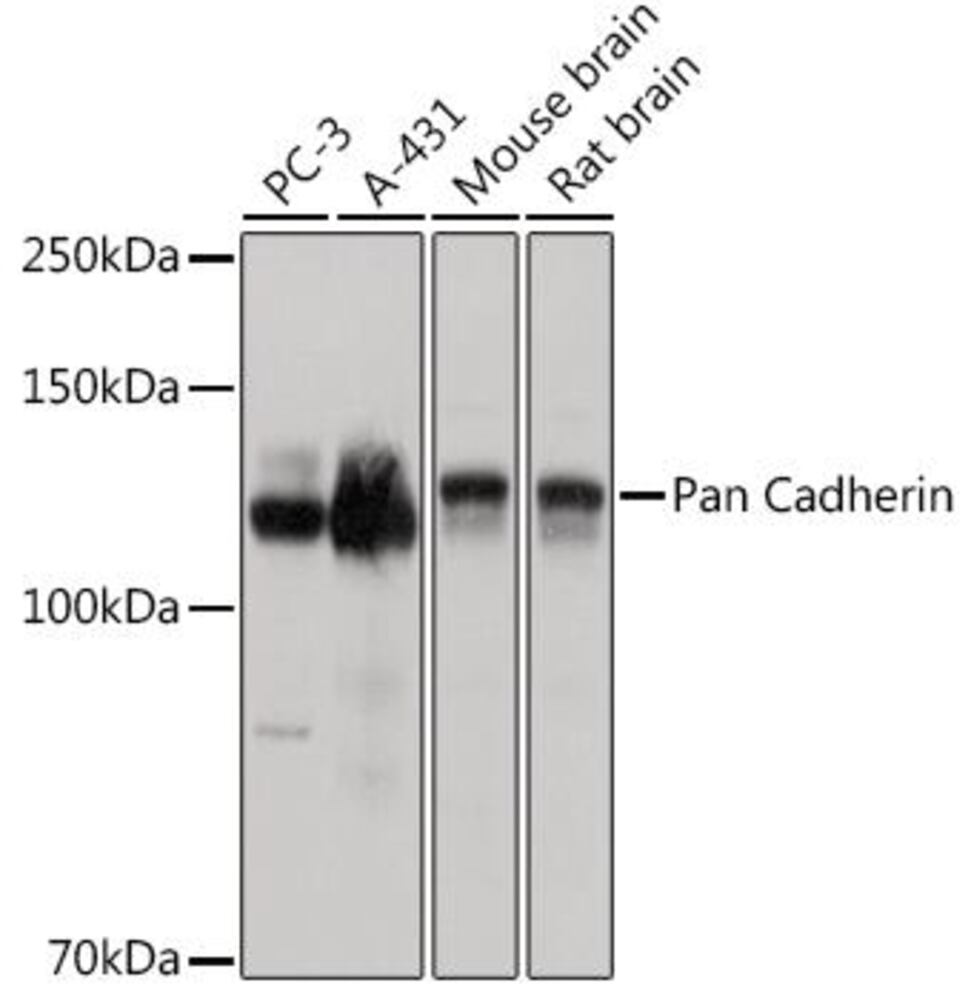 Anti-pan Cadherin Antibody, 100 µl - Luminix Health