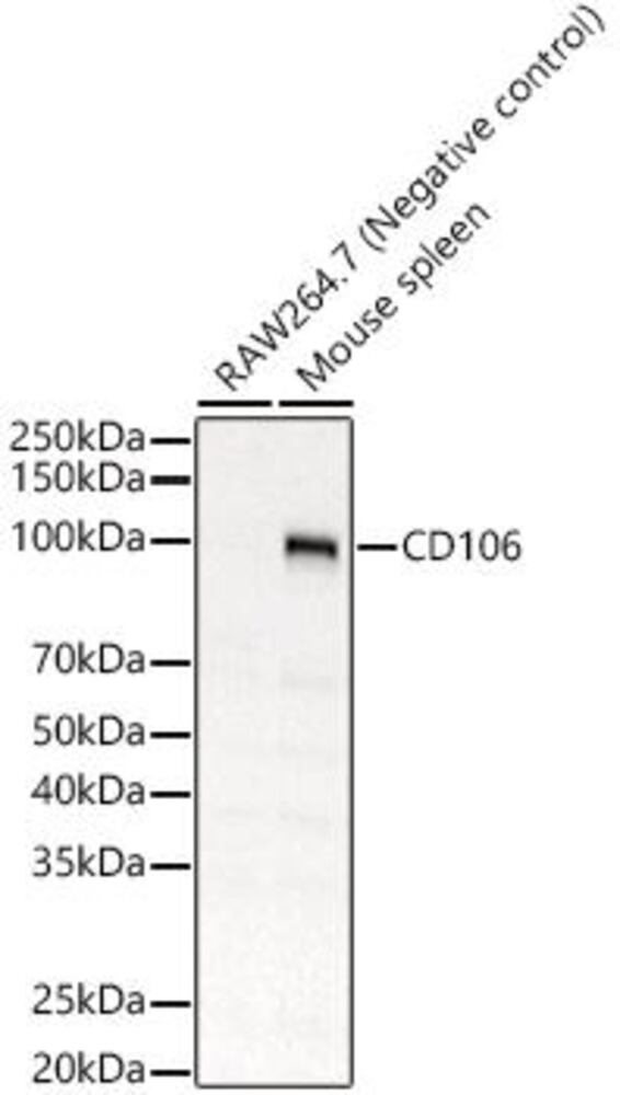 Anti-VCAM1 Antibody, 100 µl - Luminix Health