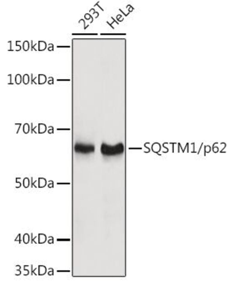 Anti-SQSTM1 / p62 Antibody, 100 µl - Luminix Health