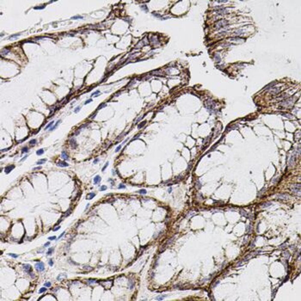 Anti-MMP9 Antibody, 100 µl - Luminix Health