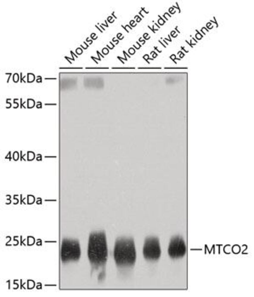 Anti-MTCO2 Antibody, 100 µl - Luminix Health