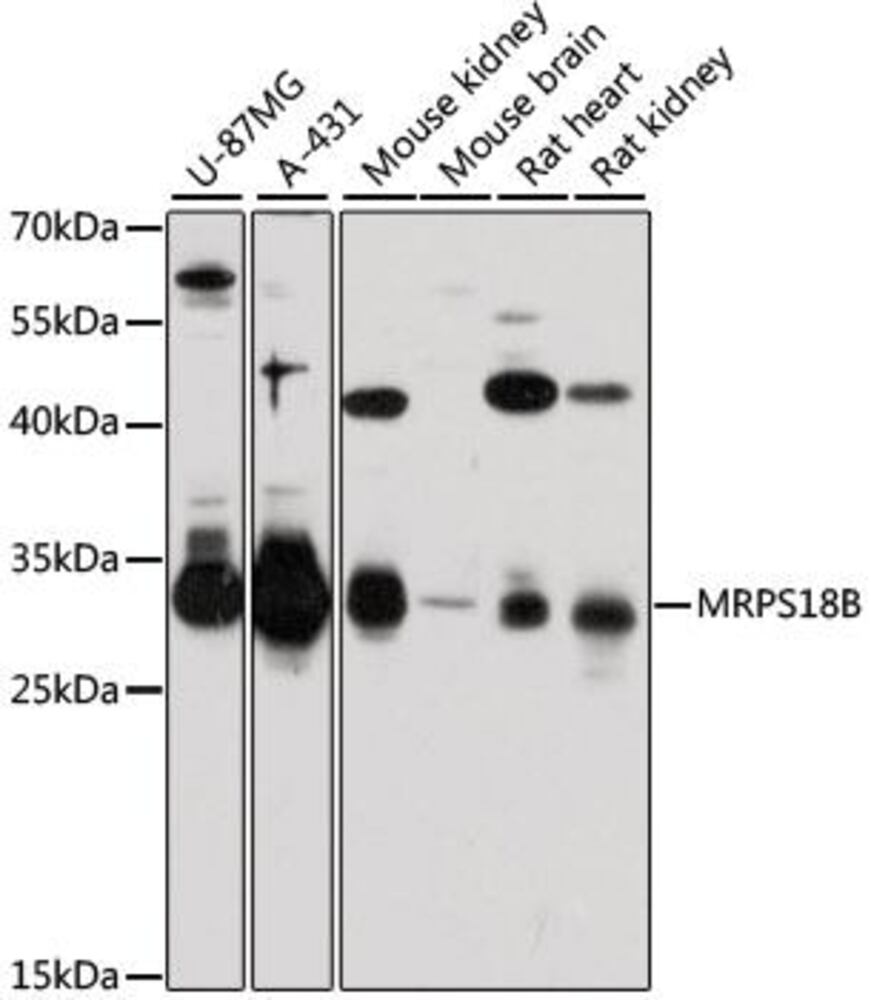 Anti-MRPS18B Antibody, 100 µl - Luminix Health