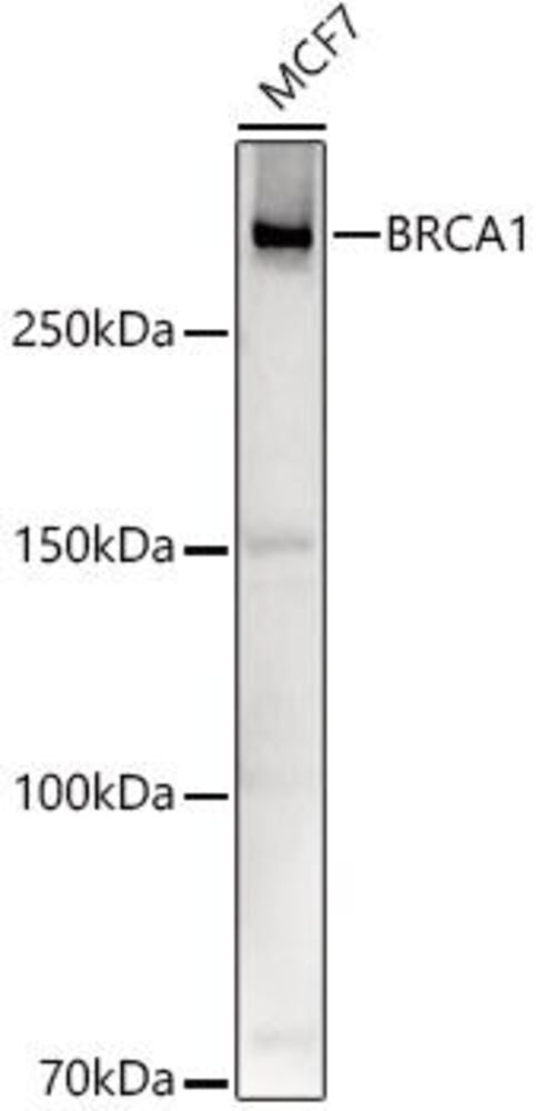 Anti-BRCA1 Antibody, 100 µl - Luminix Health