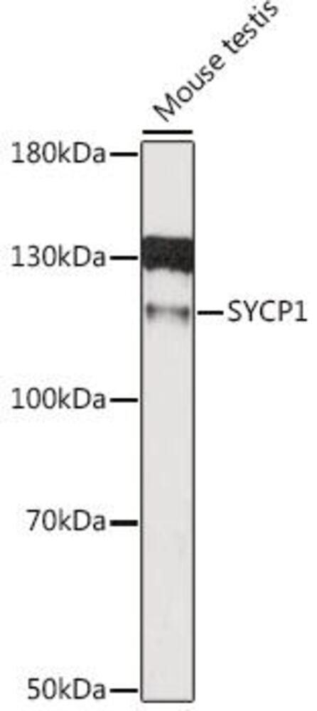 Anti-SCP1 Antibody, 100 µl - Luminix Health