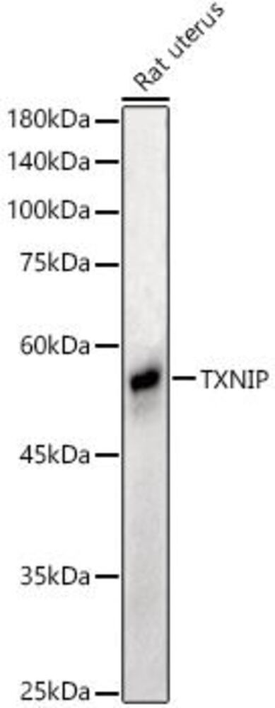 Anti-TXNIP Antibody, 100 µl - Luminix Health