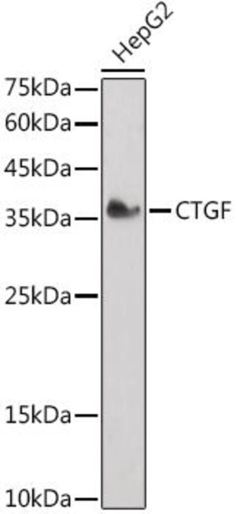 Anti-CTGF Antibody, Density (D) 1 g/cm³, Storage temp. +4 °C - Luminix Health