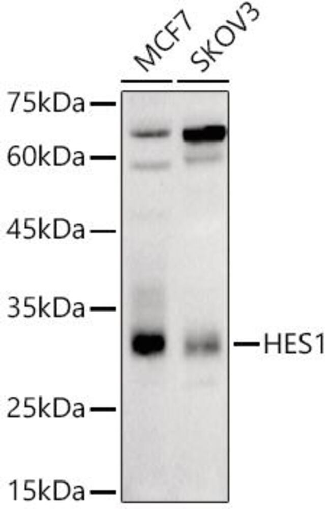 Anti-Hes1 Antibody, 100 µl - Luminix Health