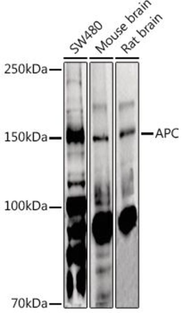 Anti-APC Antibody, 100 µl - Luminix Health