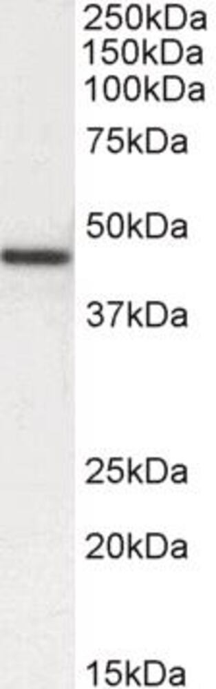 Anti-alpha Smooth Muscle Actin Antibody, 100 µg - Luminix Health