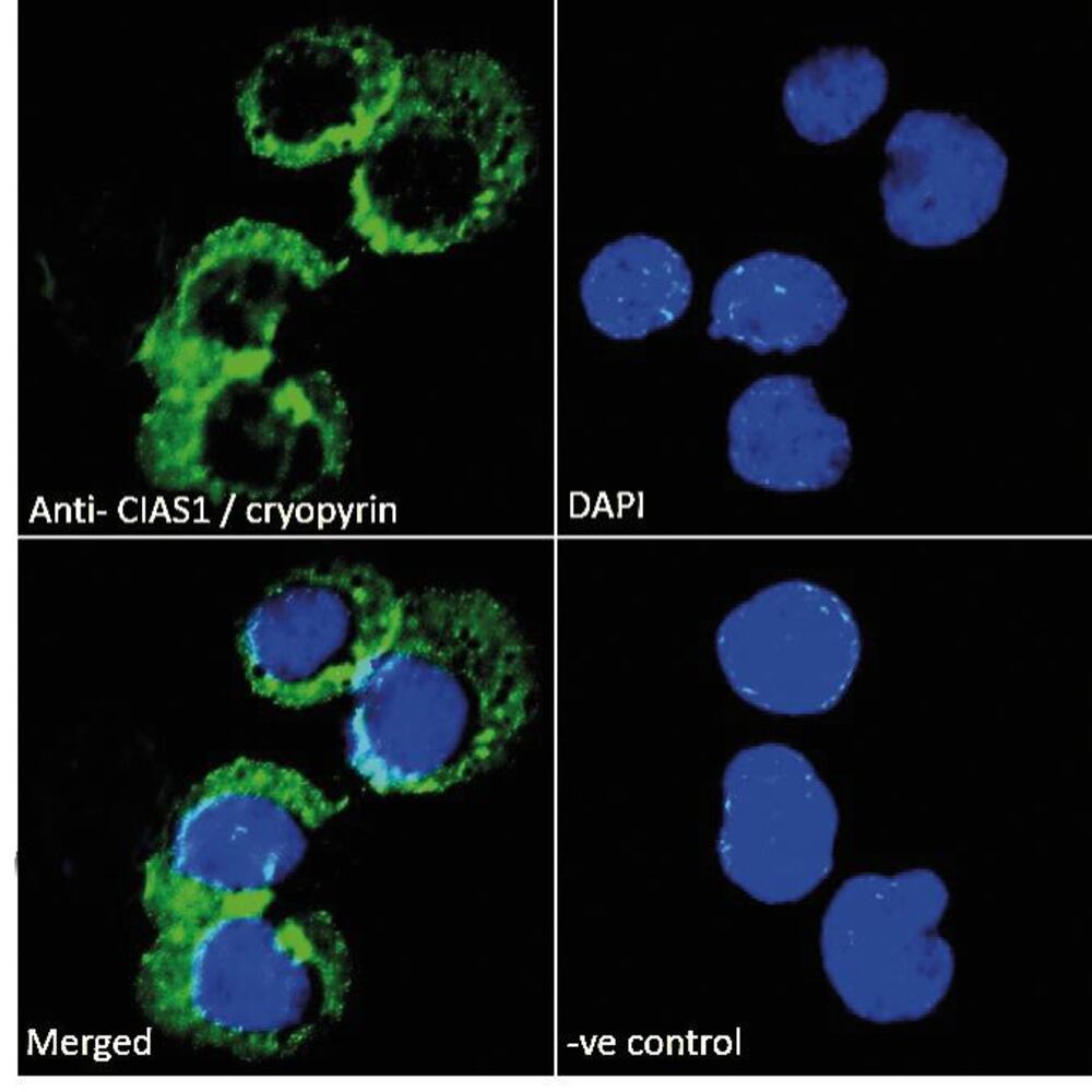 Anti-NLRP3 Antibody, 100 µg - Luminix Health