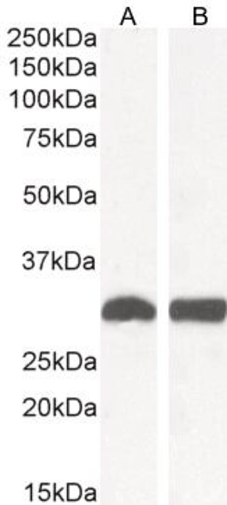 Anti-NQO1 Antibody, 100 µg - Luminix Health