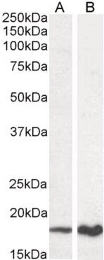 Anti-CDKN2A/p19ARF Antibody, 100 µg - Luminix Health