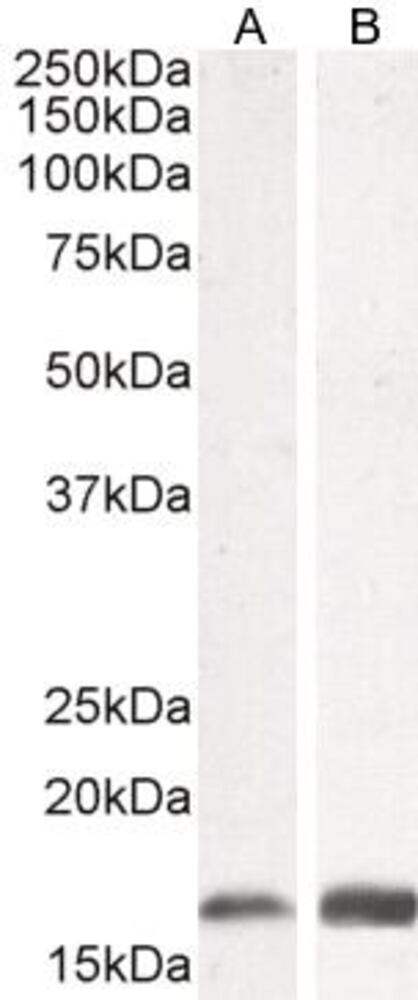 Anti-Iba1 Antibody - Luminix Health