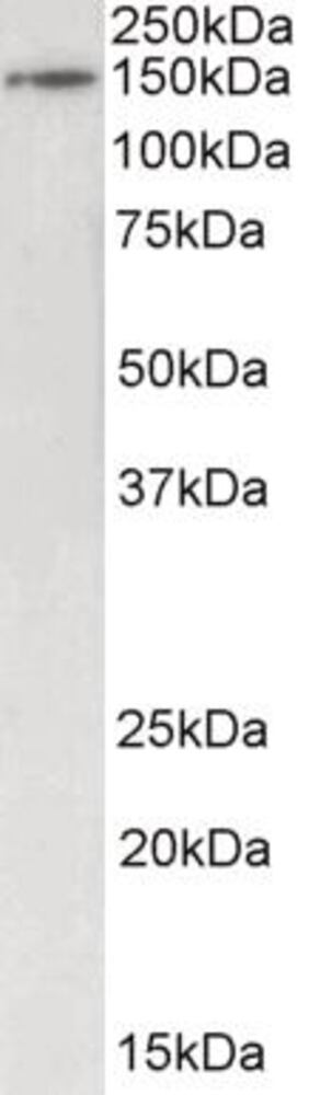 Anti-Brd4 Antibody, 100 µg - Luminix Health
