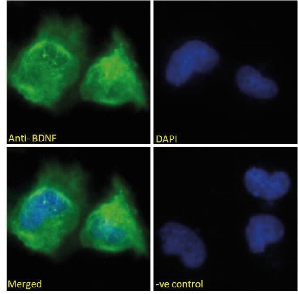 Anti-BDNF Antibody, 100 µg - Luminix Health