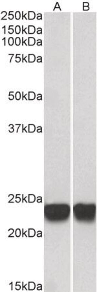 Anti-PARK7 Antibody, 100 µg - Luminix Health