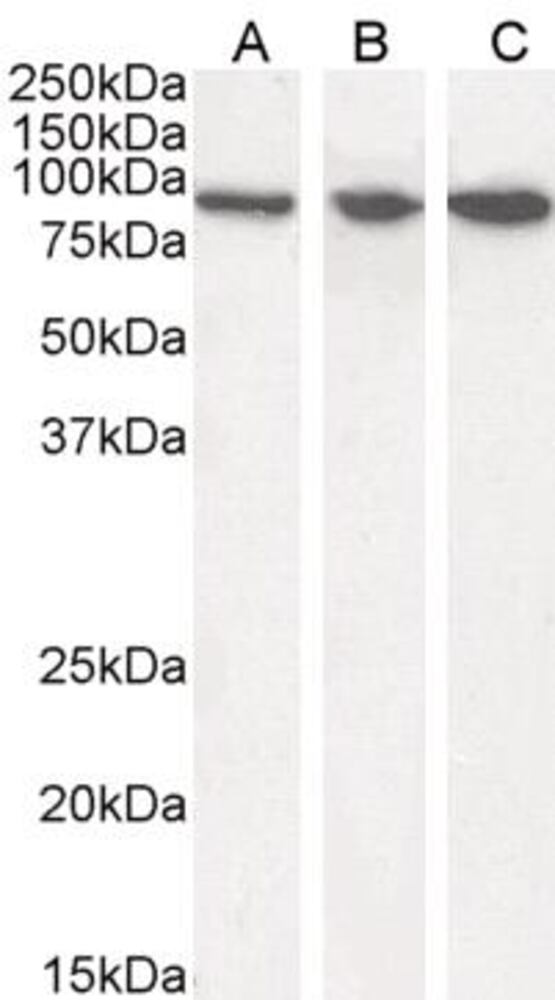Anti-VPS35 Antibody, 100 µg - Luminix Health