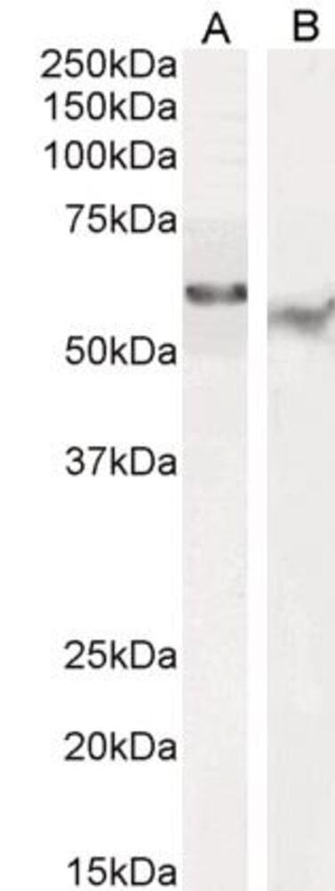 Anti-TFEB Antibody, 100 µg - Luminix Health