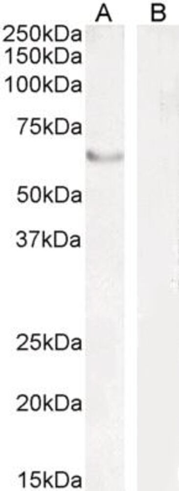 Anti-FOXC2 Antibody, 100 µg - Luminix Health