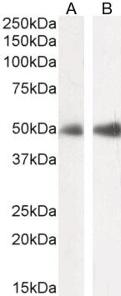 Anti-FOXL2 Antibody, 100 µg - Luminix Health