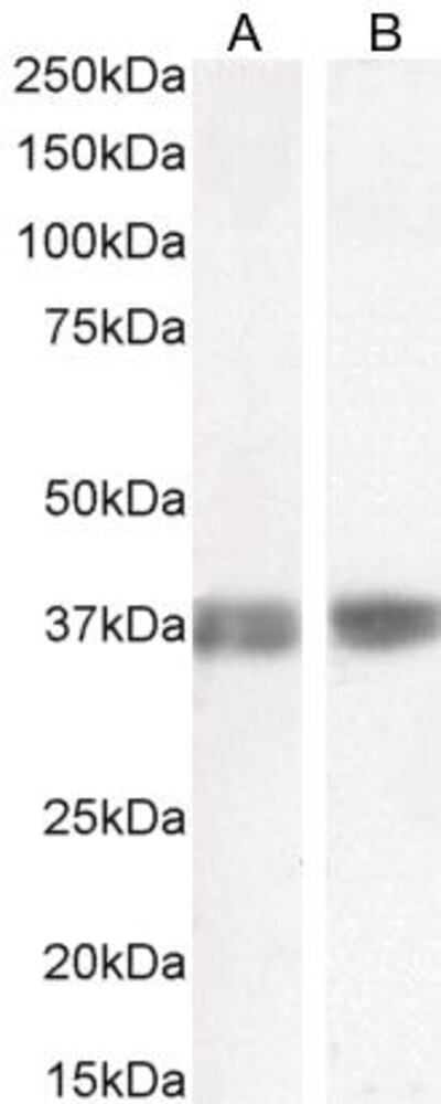 Anti-Liver Arginase Antibody, Density (D) 1 g/cm³, Storage temp. +4 °C - Luminix Health