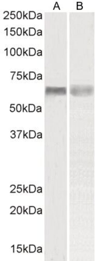 Anti-PINK1 Antibody, 100 µg - Luminix Health