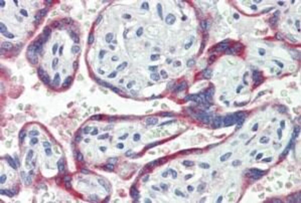 Anti-NOX2 Antibody, 100 µg - Luminix Health