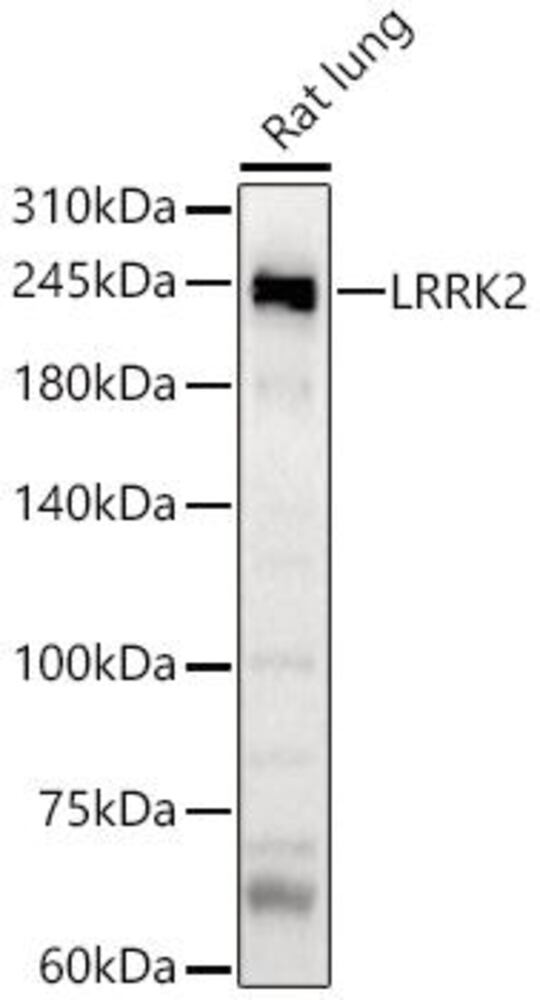 Anti-LRRK2 Antibody, 100 µl - Luminix Health