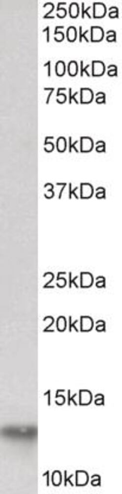 Anti-FABP4 Antibody ab195657), 100 µg - Luminix Health