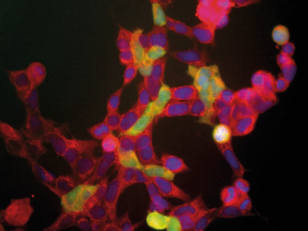 Anti-NSE Antibody, 50 µl - Luminix Health