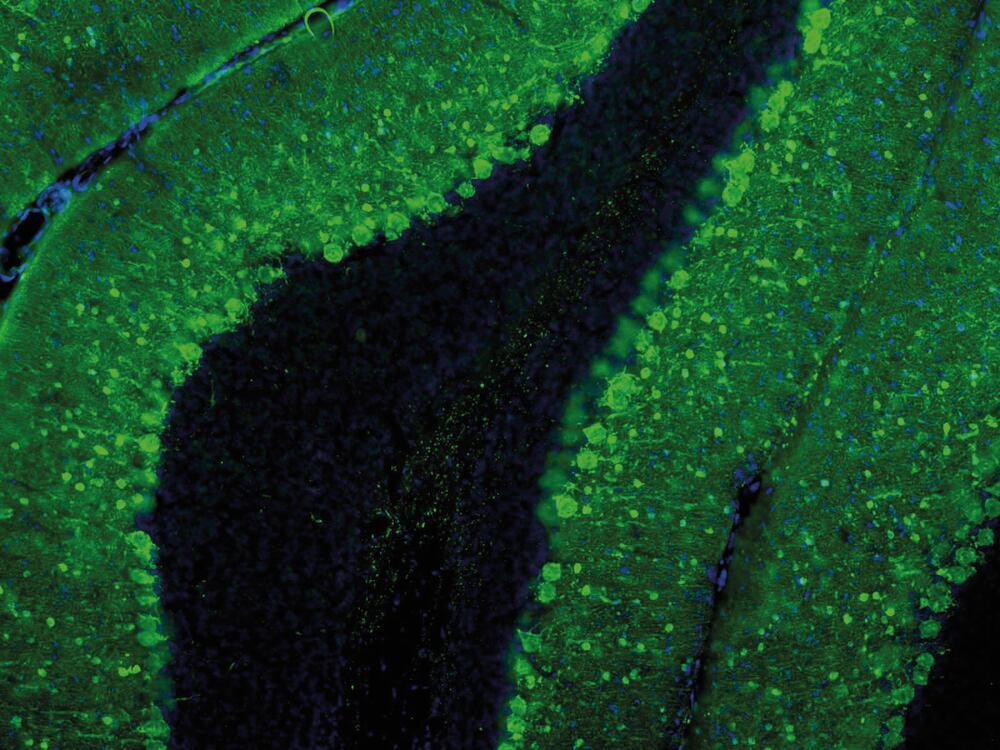 Anti-Parvalbumin Antibody, 50 µl - Luminix Health