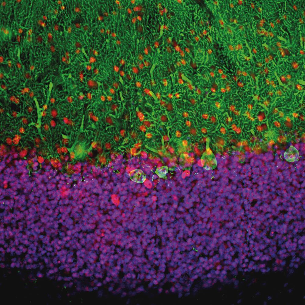 Anti-MeCP2 Antibody, 50 µl - Luminix Health