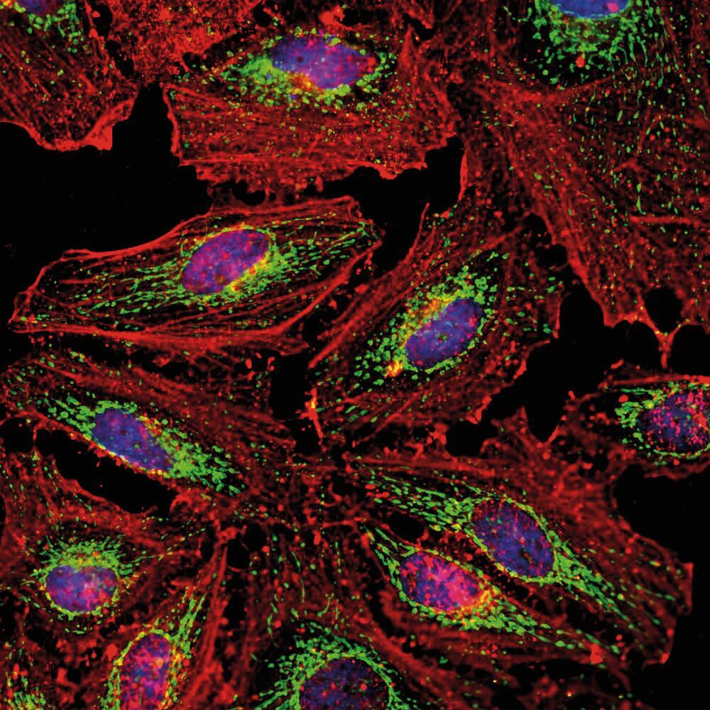 Anti-HSP60 Antibody, 50 µl - Luminix Health