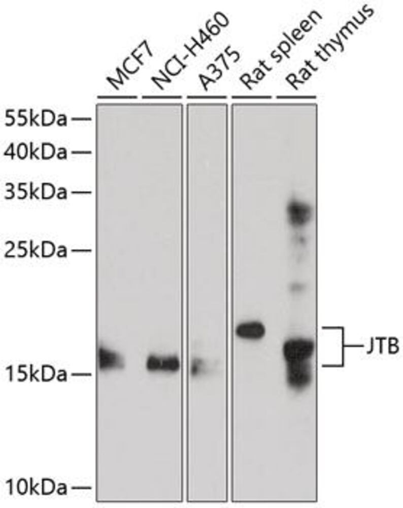Anti-JTB Antibody, 100 µl - Luminix Health