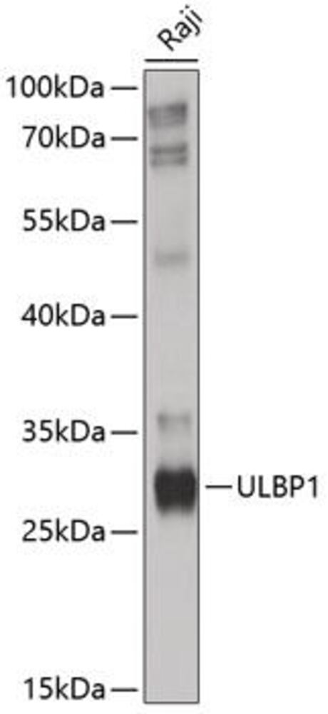 Anti-ULBP1 Antibody, 100 µl - Luminix Health