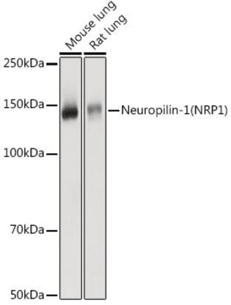 Anti-Neuropilin 1 Antibody, 100 µl - Luminix Health