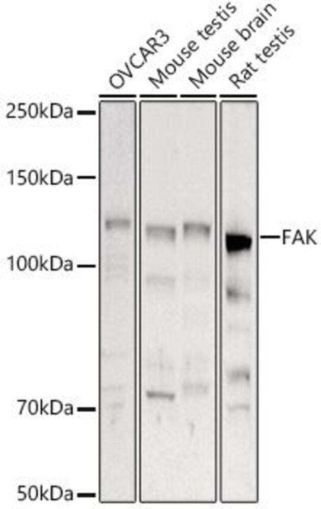 Anti-FAK Antibody, 100 µl - Luminix Health